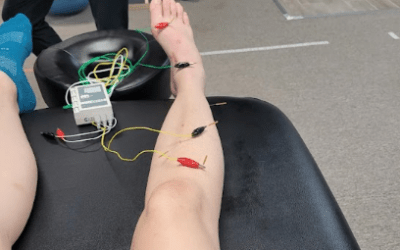Navigating Motor Vehicle Accident Recovery: Your Path to Healing with Physical Therapy in Ruther Glen, VA