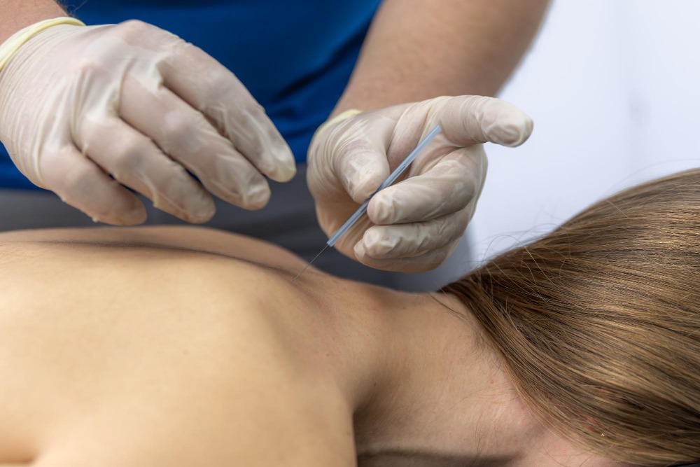 Conditions We Treat with Dry Needling in Fredericksburg